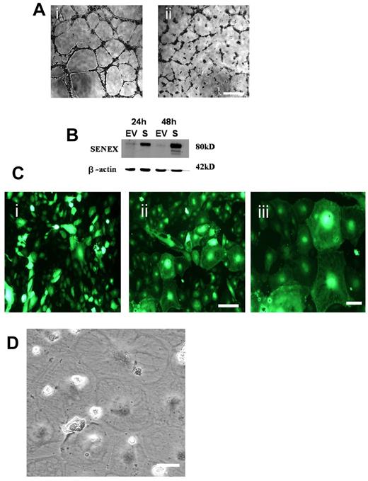 Figure 1. SENEX regulates angiogenesis and is required for EC survival. (A) HUVECs were infected with EV (i) or SENEX anti sense (ii) containing adenovirus. After 24 hours cells were plated onto Matrigel, and capillary tube formation was observed over a 24-hour time course. Photographs taken 12 hours after plating are shown. This is a representative of 3 similar experiments performed. Bars = 500 μm. (B) Expression levels of SENEX protein in HUVECs at 24 and 48 hours after infection with EV (EV) or SENEX (S) in the sense orientation in adenovirus and detected by Western blot analysis. Protein molecular masses (in kDa) appear on the right. This is a representatative of 5 experiments. (C) HUVECs were infected with EV (i) or SENEX (ii) containing adenovirus. Infected cells are visualized with green fluorescent protein (GFP). Photographs were taken after 48 hours. Bar = 220 μm. (iii) Enlarged area of cells from (B). Bar = 80 μm. (D) Phase contrast photograph of several enlarged cells. Bar = 80 μm.