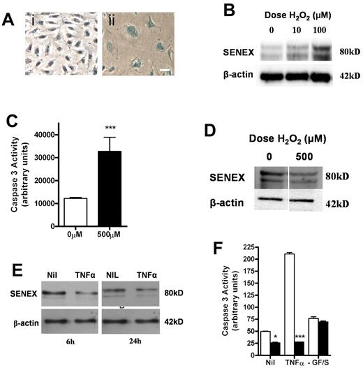 Figure 4. SENEX expression is regulated by H2O2 and TNFα. (A) HUVECs were stimulated with 100μM H2O2 for 2 hours and then placed in normal HUVEC medium for 24 hours (ii) or kept in normal HUVEC medium for 24 hours (i). Cells were then stained for β galactosidase activity. Bar = 100 μm. (B) HUVECs were stimulated as in panel A and then placed in normal HUVEC medium for 24 hours. SENEX expression was measured by Western blot with β-actin used as a loading control. This is a representative of 3 experiments. (C) HUVECs were treated with 500μM H2O2 for 6 hours and then were assessed for apoptosis using the caspase 3 activity assay. The mean ± SEM of 6 replicates from 3 lines of HUVECs is shown. ***P < .001 compared with no H2O2 treatment. (D) HUVECs were treated as in panel C. SENEX expression was measured by Western blot with β-actin as a loading control. This is a representative of 3 experiments. (E) Cells were treated with 10 ng/mL of TNFα in normal HUVEC medium for 24 hours. Protein lysates were harvested at 6 and 24 hours and the SENEX protein levels were measured using Western blotting. β-actin was used as a loading control. This is a representative of 3 experiments. (F) HUVECs were infected with SENEX (■) and EV (□) adenovirus for 24 hours. They were treated with 10 ng/mL TNFα in normal HUVEC medium for 24 hours or cultured in serum-free HUVEC medium for 24 hours or left untreated. Protein lysates were harvested and apoptosis measured using a caspase 3 activity assay. The mean ± SEM of 6 replicates from 3 lines of HUVECs is shown. *P < .05 and ***P < .001 compared with EV.