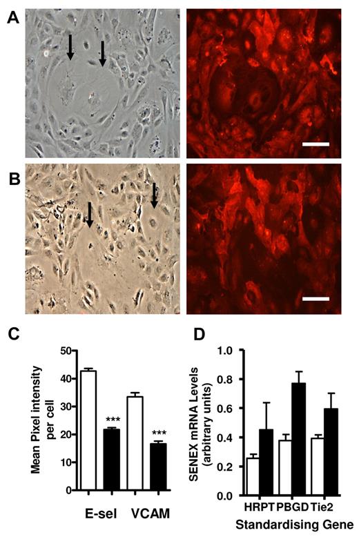 Figure 7. H2O2 induced senescent ECs are non inflammatory. HUVECs were stimulated with 100μM H2O2 for 2 hours and then placed in normal HUVEC medium for 24 hours. They were then replated into Labtek slides and 24 hours later stimulated with 5 ng/mL TNFα for 5 hours then stained for E-selectin (A) or VCAM1 (B) (right panels); Bar = 220 μm. Phase contrast photographs of the area for adhesion molecule expression are given in the left panels. (C) Senescent and nonsenescent cells were analyzed for cell surface expression of E-selectin and VCAM1. The mean pixel intensity per cell was measured using ImageJ for senescent cells (■) and for neighboring nonsenescent cells (□). The E-selectin data are a representative of the mean ± SEM of 33 senescent cells and nonsenescent cells from 2 HUVEC lines. ***P < .001 compared with nonsenescent cells. The VCAM1 data are a representative of the mean ± SEM of 17 senescent cells and the corresponding area of nonsenescent cells from 2 HUVEC lines. ***P < .001 compared with nonsenescent cells. (D) Total RNA was extracted from the aortas of male ApoE−/− mice that were on a Western diet for 1 (□) and 5 months (■). The RNA was subjected to reverse transcriptase followed by Q-RT-PCR, as described in Methods. mRNA expression of Senex was assessed and standardized to Pbgd, Hrpt, and Tie2. Quantification of Senex levels was standardized to the 3 housekeeping genes.