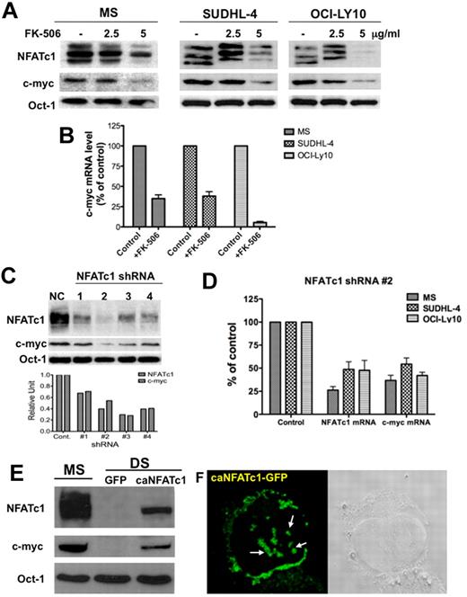 Figure 2. NFATc1 regulates c-myc protein expression in DLBCL. (A) DLBCL MS, SUDHL4 and OCI-LY10 cells were treated with FK-506 (2.5 and 5 μg/mL) for 24 hours. Nuclear extracts (25 μg) were subjected to Western blotting for NFATc1, c-myc, and Oct-1 (loading control). (B) Purified RNA from control and FK-506 treated cells from part A was analyzed for c-myc mRNA expression. (C) DLBCL MS cells were transfected with a control shRNA (NC) or NFATc1 shRNA no. 1-4. Forty-eight hours after transfection, cells were harvested and nuclear extracts were purified. Nuclear extracts (25 μg) were subjected to Western blotting for NFATc1, c-myc, and Oct-1 (loading control). Densitometry analysis was performed for NFATc1 and c-myc protein bands (bottom graph). (D) DLBCL MS, SUDHL4, and OCI-LY10 cells were transfected with a control shRNA or an NFATc1 no. 2 shRNA. Forty-eight hours after transfection, purified RNA was analyzed for NFATc1 and c-myc mRNA expressions. (E) Exogenous expression of NFATc1 induces c-myc protein expression. DLBCL DS cells were infected with a retroviral vector containing a mutant NFATc1 (caNFATc1-GFP). After 48 hours of incubation, nuclear extracts (25 μg) were purified and analyzed for expression of NFATc1, c-myc, and Oct-1 proteins by Western blotting. (F) NFATc1-GFP fusion protein expression in infected DS cells was analyzed by confocal microscopic analysis, which indicates punctate nuclear and cytoplasmic expression of dephosphorylated NFATc1.