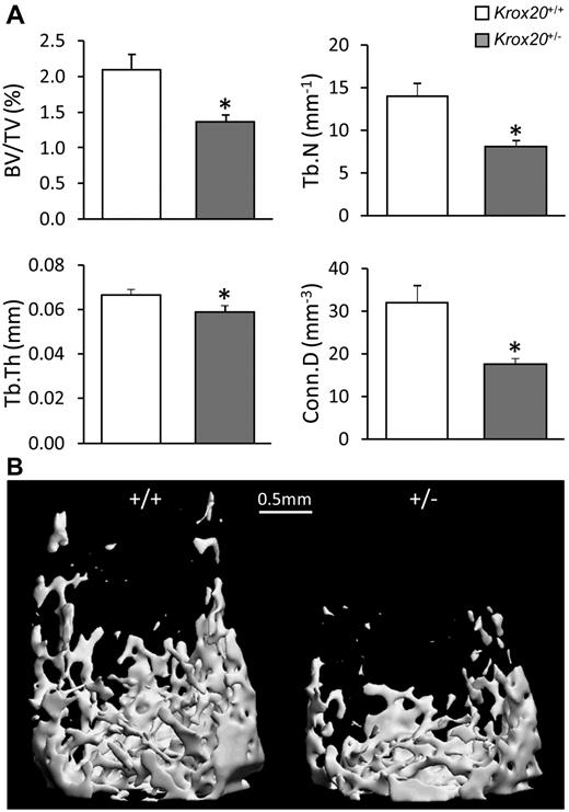 Figure 1. Low trabecular bone mass in Krox20+/− mice. (A) μCT analysis of the distal femoral trabecular bone of 10 Krox20+/+ (white) and 9 Krox20+/− (gray) 8-week-old female mice. BV/TV indicates trabecular bone volume density; Tb.N, trabecular number; Tb.Th, trabecular thickness; and Conn.D, connectivity density. Data are mean ± SEM. *P < .05 compared with WT controls. (B) μCT images of distal femoral trabecular bone of Krox20+/+ (left) and Krox20+/− (right) mice with median BV/TV values.