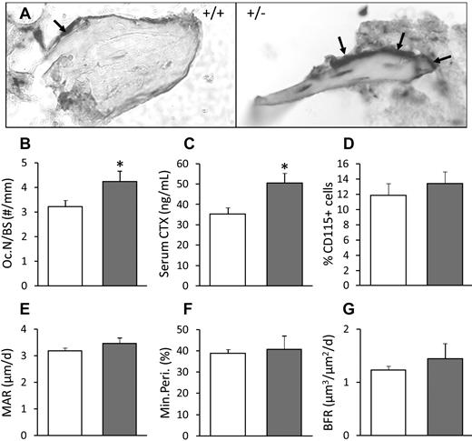 Figure 2. Increased bone resorption in Krox20+/− animals. (A) Histologic images showing increased osteoclast number and thinner trabeculae in the distal femur of WT (left) and Krox20+/− (right) animals. Arrows point at TRAP+ lining osteoclasts. Images were acquired using a Zeiss Axioskop, with a 40× objective and a SPOT digital camera. (B) Oc.N/BS, TRAP+ lining osteoclasts relative to bone surface measured in histologic sections of the distal femur from five 8-week-old mice per group. (C) Serum CTX levels in 4 WT and 3 Krox20+/− 6-week-old mice. (D) FACS analysis of CD115+ monocytes in the distal femoral metaphysis of 4 WT (left) and 5 Krox20+/− (right) 6-week-old mice. Bars show the percentage CD115+ monocytes from total red blood cell-free bone marrow cells. (E-G) Parameters of bone formation were measured in histologic sections of the distal femur from 5 8-week-old mice per group. (E) MAR indicates mineral apposition rate. (F) Min.Peri indicates mineralizing perimeter. (G) BFR indicates bone formation rate. Bars are mean ± SEM with the Krox20+/− values always on the right. *P < .05 compared with WT controls.