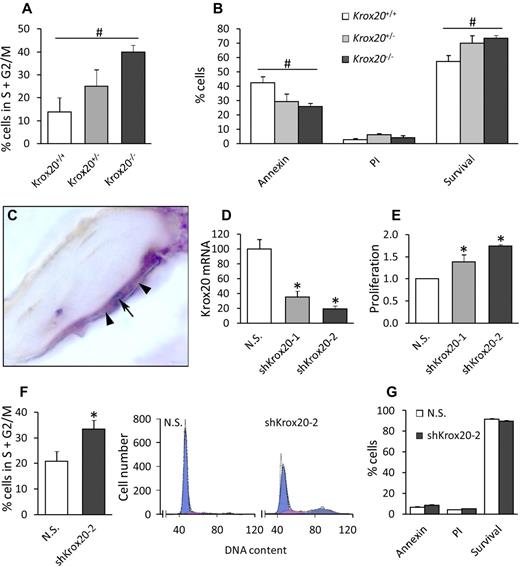 Figure 4. Silencing of Krox20 in preosteoclasts accelerates cell-cycle progression. (A) Preosteoclasts derived from WT, Krox20+/−, and Krox20−/− mice were plated in 12-well plates at 20 000 cells per well and cultured with 100 ng/mL M-CSF for 3 days before cell-cycle profiling. Bars represent percentage of cells in the S+G2/M phases. (B) Apoptosis was assessed in preosteoclasts obtained as in panel A using annexin V and propidium iodide staining. Survival corresponds to the percentage of cells negative for both FITC–annexin V labeling and propidium iodide. (A-B) Bars represent mean ± SEM; n = 4; #P < .05, 1-way analysis of variance for the effect of gene dosage. (C) Combined Krox20 immunohistochemistry (brown/black) and TRAP staining (purple) of a section from a WT distal femur, showing a representative Krox20-expressing osteoclast. Arrow points at a brown/black granular immunohistochemical reaction product indicating nuclear Krox20. Arrowheads depict faint brown cytoplasmic Krox20 immunostaining. (D) Splenocytes from WT mice were cultured for 3 days with 100 ng/mL M-CSF, and Krox20 expression was silenced using 2 different shRNA-coding lentiviruses (shKrox20-1 and shKrox20-2). Krox20 mRNA levels were determined by RT-qPCR and corrected for the corresponding expression of rpL10A. Bars represent expression levels relative to cells transduced with a nonspecific (NS) shRNA lentivirus. (E) Preosteoclasts were plated in 48-well format at 6000 cells per well and cultured with 100 ng/mL M-CSF, and Krox20 expression was silenced as in panel D. Proliferation was determined between days 4 and 9 after transduction using MTT assay. (F) Preosteoclasts were plated in 12-well plates at 20 000 cells per well and cultured with 100 ng/mL M-CSF. Cells were then transduced with lentiviruses encoding the shKrox20-2 or the NS shRNA, and cell-cycle analysis was performed as in panel A. Representative cell-cycle profiles are shown on the right. (G) Apoptosis was assessed in preosteoclasts obtained as in panel F. (D-G) Bars represent mean ± SEM; n = 4; *P < .05 vs NS.