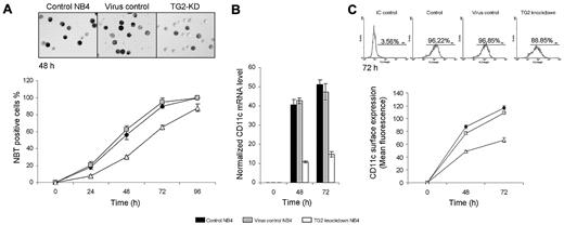 Figure 2. shRNA-induced knocking down of TG2 delays the differentiation process of NB4 cells. NB4 cells were cultured in standard medium in presence of 1μM ATRA for 0, 24, 48, 72, and 96 hours. (A) NBT reduction assays were performed (5 × 104 cells) at the indicated time points in triplicates in a 96-well plate by the addition of 1 mg/mL NBT and 2 μL (100 μg/mL) phorbol myristate acetate for 30 minutes. At least 400 cells were counted in each sample and according to their intracellular blue formazan deposit contents percentage of NBT positivity was determined. Percentage of NBT positivity is expressed as mean % ± SD for n = 3 parallel experiments. Light-microscopic image inserts show typical NBT positivity of the ATRA-treated control, virus control, and TG2 knockdown NB4 at the second-day stage of the differentiation (Zeiss Axiovert 135 inverted microscope, equipped with Achroplan 10×/0.25 Ph1; Carl Zeiss). (B) Induction of CD11c differentiation marker in ATRA-treated control, virus control, and TG2 knockdown NB4 cells were determined at the given time points of differentiation by real-time Q-PCR. Measurements were conducted in triplicates, values are expressed as mean % ± SD of the mean. (C) Differences in surface expression of CD11c between control, virus control, and TG2 knockdown NB4 cells were analyzed by flow cytometry at the indicated time points. Cells (8 × 105) were labeled with mouse antihuman CD11c IgG. Graph shows the average of the mean values of fluorescence measured in FL2 channel with ± SD. Typical flow cytometric profiles of CD11c surface expression in each cell types at the third day are shown by the inserted histograms.