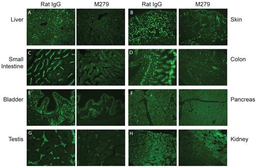 Figure 2. Anti-CSF1R antibody mediated depletion of CSF1R-EGFP+ tissue macrophages. MacGreen mice were treated with 400 μg of anti-CSF1R or control antibody (rat IgG) administered by intraperitoneal injection, thrice weekly for 3 weeks. Fluorescent micrographs comparing EGFP expression in 12-μm sections of liver (A), skin (B), small intestine (C), colon (D), bladder (E), pancreas (F), testis (G), and kidney (H) from anti-CSF1R or rat IgG-treated mice are shown. All images are 20× magnification.