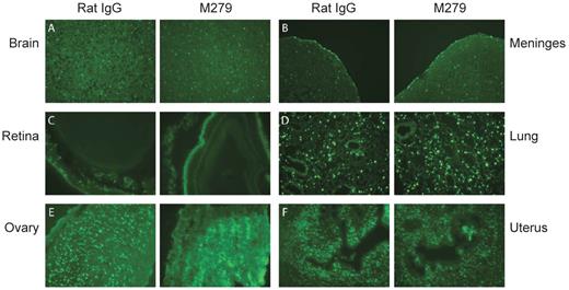 Figure 3. Tissue-specific depletion of CSF1R-EGFP+ resident tissue macrophages with anti-CSF1R antibody. MacGreen mice were treated with 400 μg of anti-CSF1R or control antibody (rat IgG) administered by IP injection, thrice weekly for 3 weeks. Shown are fluorescent micrographs of 12-μm sections of brain tissue showing parenchyma (A) and meninges (B), and of retina (C), lung (D), ovary (E), and uterus (F), from anti-CSF1R or rat IgG-treated mice. All images are 20× magnification.