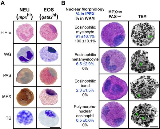 Figure 2. gata2hi cells display the morphologic, histochemical, and ultrastructural properties of eosinophils. gata2hi and mpxhi cells were FACS sorted (purity ≥ 95%) from WKM (A-B) or IPEX (B). (A) Purified gata2hi (EOS) and mpxhi (NEU) cells were stained with hematoxylin and eosin, WG, PAS (red precipitate), MPX (brown precipitate), and TB (purple precipitate). Bar represents 5 μm. (B) Purified gata2hi cells were subjected to double staining with MPX and PAS or TEM analysis. A representation of each nuclear morphology (myelocyte, metamyelocyte, band, and polymorphonuclear) is shown as observed by cytospin (left) or TEM (right) analysis. Based on cytochemical analyses, the relative abundance (percentage) in either IPEX (top value) or WKM (bottom value) is provided for each morphologic class. Bar represents 2 μm. N indicates nucleus. Data are mean ± SD (n = 10).