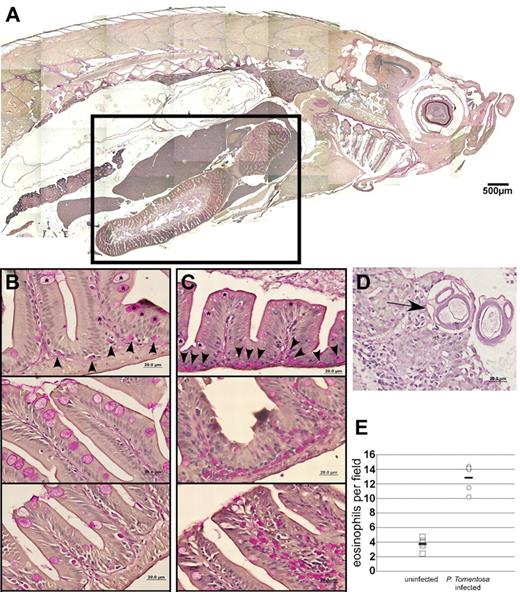 Figure 6. In vivo infection by P tomentosa leads to colonization of the gut and peritoneal cavity and an increase in local eosinophil number. (A) Composite image of sagittal section of adult zebrafish, stained with PAS. Inset: Area including intestines, shown in close-up views in panels B and C. (B) Imaging of the gut in uninfected animals shows nucleated PAS+ eosinophils interspersed along the basal lamina propria (arrowheads). Intestinal goblet cells (asterisks) are also PAS+, but distinct from eosinophils. (C) Infected animals show an increased number of PAS+ eosinophils along the basal lamina propria and also distally localized into villi. (D) P tomentosa larvae are observed within gut tissue (arrow). (E) Counts of eosinophils increase approximately 3-fold in intestines of infected animals. Images in panels A through D were acquired with an Olympus DP70 microscope and collected with Olympus DP Controller Version 2.1.1.183 and processed with Adobe Photoshop CS. Panel A is a composite image of a PAS and hematoxylin-stained section taken with a 10× dry objective. Images in panels B through D were taken with a 100× oil immersion objective and stained with PAS and hematoxylin.