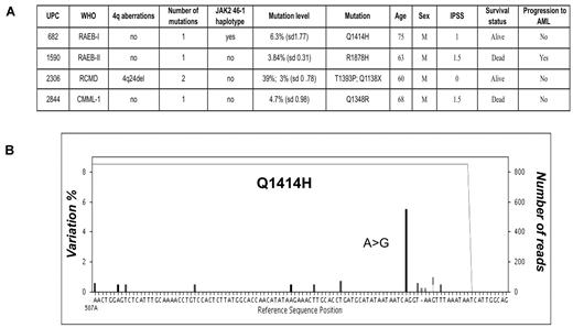 Figure 3. Deep sequencing reveals low-level mutant clones. (A) After deeper sequencing at 450× coverage for 96 patients, an additional 4 mutations were identified, which were present at between 3% and 6.3% RMA within total bone marrow DNA. One of these mutations was found in a patient with an additional mutation, which had previously been identified. Means and standard deviations for RMA corresponding to 3 independent experiments are shown. (B) Representative sequence readout for 1 of these mutations is exampled and shows an A>G substitution, denoted by the prominent black bar, in 6% of sequence reads (6% variation from the reference sequence, left axis), leading to a Q1414H nonsynonymous amino acid change. The sequence depth is 820× across this region traced by the gray line running across the top of the graph. Experimental noise accounts for ≤ 1% of variation.