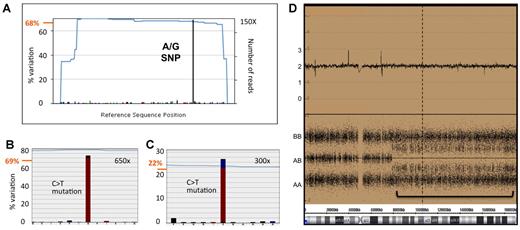 Figure 5. The quantitative nature of NGS provides greater insight into LOH events. For UPC 2719, representative sequence read-out for one SNP (A) and 2 mutations (B-C) are displayed alongside SNP array data (D), showing a UPD over the TET2 locus. (A) An A to G SNP found in TET2 exon 11 is depicted by the dominant black bar and is found at 68% RMA (68% variation from the reference sequence indicated on the left axis), indicative of homozygosity and LOH in a population with mixed clonality. (B-C) Likewise, a C to T mutation in TET2 exon 7 is found at 69% RMA and another in exon 10 at 22% RMA, respectively, again indicative of multiple and distinct disease clones. The sequence coverage (number of reads) across the regions is indicated outside or inside the right axis in panel A or panels B and C, respectively, and traced by the blue lines in all cases. (D) Consistent with the sequence data, SNP6 array data show a region with LOH, indicative of UPD, highlighted by the green bar. The top panel represents a smooth copy number signal plot and a copy number of 2. The bottom panel shows individual genotypes for the SNP probes and a background of AB heterozygote calls consistent with mixed clonality.