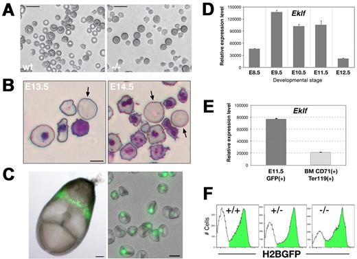 Figure 1. Eklf-deficient primitive erythroblasts show dramatic alterations in cell morphology but can complete their maturation. (A) Wet preparations of freshly harvested E14.5 PB cells reveal large Eklf-null mutant EryP that fail to achieve the discoidal shape observed for WT cells. (B) Detail of Giemsa-stained cytospin preparations of PB from E13.5 and E14.5 mutant embryos, showing some macrocytic cells that lack nuclei (arrows). (C) Left panel, H2B-GFP expression in an E8.0 transgenic embryo. Right panel, wet preparation of PB from an E14.5 ϵ-globin::H2B-GFP embryo. An overlay of bright field and green fluorescence is shown. Expression of the fluorescent reporter is restricted to the EryP nucleus. (D) Expression of Eklf mRNA in developing EryP cells. GFP+ cells were sorted from E8.5-12.5 embryos and real-time RT-PCR analysis of Eklf was performed; expression was normalized to that of ubiquitin b. (E) Eklf expression in definitive versus primitive erythroid cells. GFP+ EryP from E11.5 embryos or CD71+Ter119+ definitive erythroid cells from adult mouse BM were sorted and the expression of Eklf mRNA assessed by real time RT-PCR; expression levels are relative to ubiquitin b. A representative experiment (3 independent samples) is shown. (F) Histograms of ϵ-globin::H2B-GFP fluorescence intensity in E13.5 PB cells harvested from Eklf WT, Eklf+/− or Eklf−/− embryos. Images were acquired in AxioVision v4.6 using a Zeiss AxioCam digital color camera mounted on a Zeiss Axiovert 25 inverted microscope outfitted with a 20× (LD-A-Plan/0.3 NA) or 32× (LD-A-Plan/0.4 NA) objective (A-C right panel) or on a Leica MZ12 stereomicroscope outfitted with a plan apo 1.0× objective (C, left panel). Scale bars: A, 20 μm; B, 10 μm; C, left panel, 100 μm, and right panel, 10 μm.