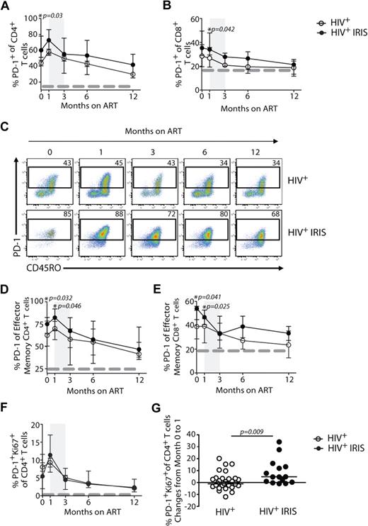 Figure 4. Higher frequencies of PD-1 expressing cells are found in IRIS patients before ART initiation. The percentage of PD-1 expression within CD4+ T and CD8+ T lymphocytes in HIV+ controls (open symbols) and HIV+ IRIS patients (filled symbols) were measured before and after ART initiation (A-B). Representative dot plots showing PD-1 expression on CD4+ T cells throughout study follow-up. Upper dot plots represent a single HIV+ control patient and lower dot plots represent a single HIV+ patient who developed one IRIS episode (C). The percentage of PD-1 expression within the effector memory compartment of CD4+ T and CD8+ T cells in HIV+ controls (open symbols) and HIV+ IRIS patients (filled symbols) were measured before and after ART initiation (D-E). Percentage of PD-1+Ki67+ expression within CD4+ T lymphocytes was measured before and 1, 3, 6, and 12 months after ART initiation. The dotted line represents median of the given measurement from healthy donors (F). The shaded area represents the IQR of the time of initiation of IRIS episodes, and dotted lines represent median of the given measurements from healthy donors (A-B, D-F). Symbols represent changes in the frequency of PD-1+Ki67+ cells among CD4+ T cells in individual patients from baseline to month 1 after ART initiation (G).