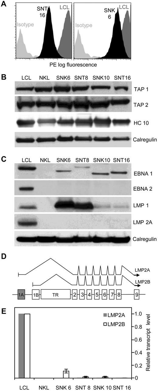 Figure 1. Antigen processing and presentation capability of EBV-positive T and NK tumor lines. (A) Flow cytometric analysis of cell surface HLA class I. Representative data from 2 lines (SNT 16 and SNK 6, black shading) compared with a LCL (dark gray shading) is shown. (B) Western blot of whole cell lysates probed with antibodies to transporter associated with antigen processing (TAP) 1 and 2 and total cellular class I heavy chains (HC 10) in NK- and T-cell lines, shown relative to levels in a LCL. Calregulin serves as the loading control. (C) EBV antigen expression in NK- and T-cell lines. Western blot of whole cell lysates of EBV-positive NK- and T-cell tumor lines probed with antibodies to EBNA 1, EBNA 2, LMP1, and LMP2A compared with a LCL and an EBV-negative NK line (NKL). Note the different molecular weight of EBNA 1 in the different lines is attributable to the variable size of the Gly-Ala repeat domains. (D) Schematic indicating the exon structure of the LMP2 gene and splicing patterns of conventional LMP2A and LMP2B transcripts, across the TR region of the genome. Each transcript contains a unique 5′ first exon (1A for LMP2A, shaded gray and 1B for LMP2B, shaded white). (E) Real-time PCR for LMP2A and LMP2B mRNA. Gray and white shaded bars represent quantities of LMP2A and LM2B transcripts, respectively, relative to a LCL. Error bars indicate SDs from the mean.