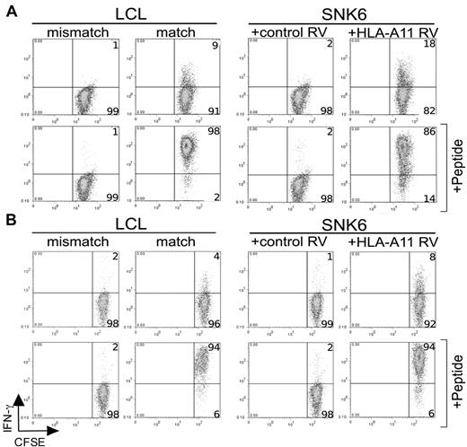 Figure 4. LMP2-specific T-cell recognition of SNK 6 exceeds that of a LCL. Dual-color flow cytometry: the x-axis represents fluorescence from CFSE-stained CD8+ effectors, and the y-axis denotes IFN-γ release as determined by intracellular staining. CFSE-negative cells (ie, LCL or SNK 6 targets) have been gated out of this analysis. HLA class I–mismatched LCLs and SNK 6 transduced with a control retrovirus (+ control RV) are negative controls. The top plots within panels A and B indicate T cells expressing IFN-γ in response to endogenously processed peptide, while the bottom plots of each panel show IFN-γ expression by T cells after preincubation of targets with exogenous cognate peptide (+ peptide). Numbers in the right quadrants indicate the percentage of cells positive (top quadrant) or negative (bottom quadrant) for IFN-γ release. (A) SSC-specific CD8+ clones tested against HLA-matched LCLs and SNK 6-A11. (B) Effector T cells expressing a recombinant SSC/A11 TCR tested against A11+ LCL and SNK 6-A11.