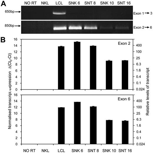 Figure 5. Expression of a LMP2 transcript containing exons 2 to 6 in EBV positive NK- and T-cell tumor lines. (A) End point PCR products (35 cycles) visualized on a 1% agarose gel. Amplification of cDNA using a forward primer located in exon 1 and reverse primer within exon 3 (F1 and R3; see supplemental Table 1) yields a product of expected size in the LCL but no product in the NK- and T-cell lines. PCR performed with a forward primer in exon 2 and a reverse primer located within exon 6 (F2 and R6) produces a product of the anticipated size in all 4 NK- and T-cell lines. The EBV negative NK leukemia cell line, NKL, and a no reverse transcriptase (NO RT) sample from a LCL served as negative controls. (B) Quantitative RT-PCR assays, using primers and probes designed to amplify LMP2 transcripts containing exons 2 and 6, respectively (avoiding exon-exon junctions in the event of uncharacterized splice variations). Data are expressed using cycle threshold (Ct) values, where Ct0 represents the assay threshold of detection. LMP2 transcript Ct values are normalized to cellular glyceraldehyde 3-phosphate dehydrogenase (GAPDH) Ct values. The left-hand y-axis represents Δ(Ct0-Ct), while the right-hand axis shows the relative transcript levels.