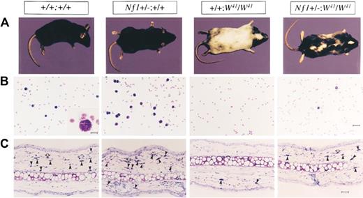 Figure 2. Effect of haploinsufficiency of Nf1 on coat color and total numbers of cutaneous and peritoneal mast cells. (A) Coat color pattern of a representative mouse from each of the following genotypes: +/+;+/+, Nf1+/−;+/+, +/+;W41/W41, and Nf1+/−;W41/W41. Haploinsufficiency at Nf1 partially corrects the coat color deficiency in mice homozygous for the W41 allele in a C57BL/6 genetic background. (B) Representative cytospins from peritoneal lavages stained for mast cells from individual mice of the 4 Nf1 and W genotypes. Peritoneal cells were stained with toluidine blue to quantify the total number of mast cells per peritoneal lavage. A WT mouse (original magnification ×200). Bar (inset), 10 μm. Bar (far right), 30 μm. (C) Representative ear biopsies stained for cutaneous mast cells from individual mice of the 4 Nf1 and W genotypes. Specimens were stained with hematoxylin-eosin to assess routine histology and with Giemsa to identify mast cells. Ear biopsies were stained with Fontana-Masson to differentiate melanin-containing cells from mast cells. Cutaneous mast cells (Giemsa-positive, Fontana-Masson–negative) were quantitated in a blinded fashion by counting the distal 5 mm of ears. Black arrows indicate Giemsa-positive mast cells, and open arrows indicate Fontana-Masson melanin–containing cells. Bar, 35 μm. Originally published in Ingram et al.36