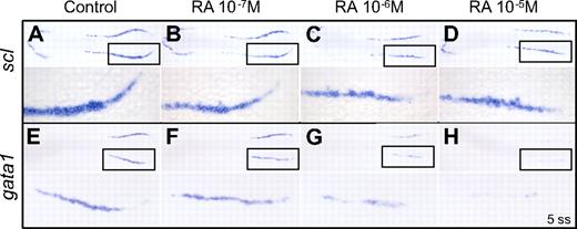 Figure 1. RA inhibits primitive erythropoiesis in WT zebrafish embryos. Dorsal view of flat-mounted 5-ss wild-type AB embryos. Head is oriented to the left, posterior embryo to the right. Higher power view in the bottom panels is indicated by the boxed region in the top panels. Representative embryos are shown from a single experiment. Similar results were obtained from 2 other replicate experiments. (A-D) Whole-mount in situ hybridization for scl expression in embryos treated with increasing concentrations of RA from 90% epiboly until 5 ss. (E-H) Whole-mount in situ hybridization for gata1 expression in embryos treated with increasing concentrations of RA from 90% epiboly until 5 ss. All embryos are fixed at 5 ss.