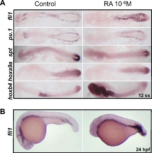 Figure 2. RA has varying effects on other genes expressed in the posterior mesoderm. (A). Flat-mounted 12-ss embryos are shown after whole-mount in situ hybridization with the probes indicated. Treatment with 10−6M RA was applied to wild-type AB embryos from 90% epiboly until 12 ss. Representative embryos are shown from a single experiment. Replicate experiments showed comparable results in at least 2 other experiments with each probe. All the embryos from a given treatment group had similar expression patterns. (B). Whole-mounted embryos at 24 hpf. Treatment with 10−6M RA was applied from 60% epiboly until 10 ss, then washed out. Embryos were then fixed at 24 hpf before whole-mount in situ hybridization with fli1 riboprobe. Representative embryos from 1 of 3 experiments are shown.