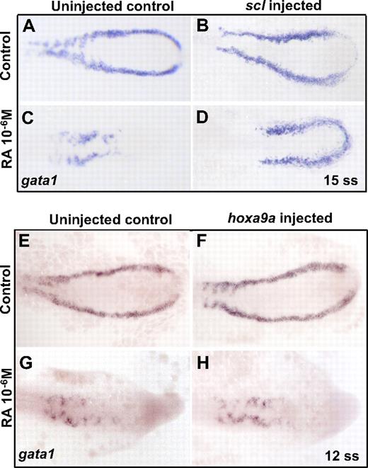 Figure 3. Overexpression of scl, but not hoxa9a, increases gata1 in RA-treated embryos. Representative embryos are shown for each experiment. Similar results were observed in at least 2 other replicate experiments. (A-D). Single-cell embryos were injected with scl mRNA, then incubated in 10−6M RA from early gastrulation (60% epiboly) until mid somitogenesis (15 ss). Expression of gata1 was measured by whole-mount in situ hybridization after embryos were fixed at 15 ss. (E-H) Single-cell embryos were injected with hoxa9a mRNA and then incubated in 10−6M RA from early gastrulation (50% epiboly) until mid somitogenesis (12 ss). Expression of gata1 was measured by whole-mount in situ hybridization after embryos were fixed at 12 ss. Similar experiments incubating injected embryos in 10−6M RA from late gastrulation (90% epiboly) until mid somitogenesis (12-15 ss) showed comparable results.