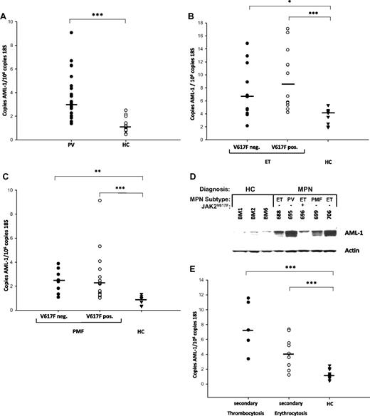 Figure 5. AML1 expression in MPN patients. (A) AML1 expression in PV patients and healthy controls. (B) AML1 expression in JAK2V617F-positive and -negative ET patients and healthy controls. (C) AML1 expression in JAK2V617F-positive and -negative PMF patients and healthy controls. (D) AML1 expression in erythroid progenitors of MPN patients and healthy controls. Erythroid progenitor cells were cultured from 5 MPN patients and 3 healthy controls as described24 and interrogated for AML-1 and beta-actin expression by Western blot. HC indicates healthy controls. (E) AML1 expression in secondary erythrocytosis and thrombocytosis. (A-C and E) RNA was isolated from purified granulocytes of 31 PV patients, 12 JAK2V617F-positive and 11 JAK2V617F-negative ET patients, 17 JAK2V617F-positive and 8 JAK2V617F-negative PMF patients, 5 patients with secondary thrombocytosis and 11 patients with secondary erythrocytosis, and 28 healthy controls as indicated and subjected to quantitative RT-PCR analysis for AML1 expression. A standard curve with known copy numbers of AML1 and 18S rRNA was included on each plate. Sample copy numbers of AML1 and 18S rRNA were determined from the standard curve and are expressed as relative ratios (copy number AML1 per 106 18S molecules). The median is depicted by a horizontal line; *P < .05, **P < .01, ***P < .001 by Kruskal Wallis one-way ANOVA on Ranks and Mann-Whitney Rank sum test.