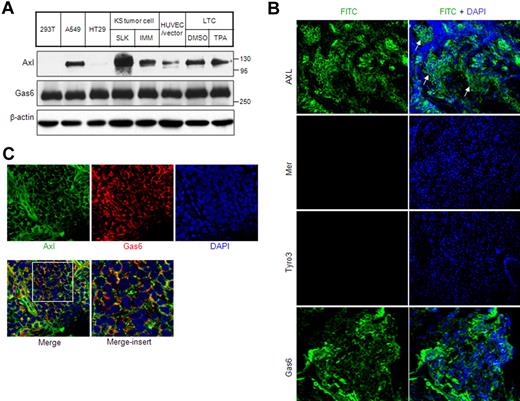 Figure 1. Axl and Gas6 expression in KS cells and KS tissue. (A) Expression of Axl and Gas6 in KS cell lines and endothelial cells infected by KSHV was analyzed by Western blot of whole-cell lysates. Cell lines 293T and HT29 were used as a negative control for Axl expression. A549 cell was used as a positive control. HUVEC/vector is a HUVEC line immortalized by telomerase, as described in “Cell culture.” (B) Axl, Mer, Tyro3, and Gas6 expression in human KS tissue was analyzed by immunostaining. Nuclei were counterstained with DAPI. The KS tumor regions are indicated by arrows. Images were taken with an Olympus AX70 fluorescence microscope (20× objective) and Spot Version 2.2.2 digital imaging system. (C) Confocal imaging of Axl and Gas6 colocalization in human KS tumor. (Bottom panel) Merged staining of Axl, Gas6, and nuclei. Enlarged view of the white-bordered insert in the lower left picture was shown on the right. Images were taken with a Carl Zeiss confocal microscope (100× objective) and LSM software.