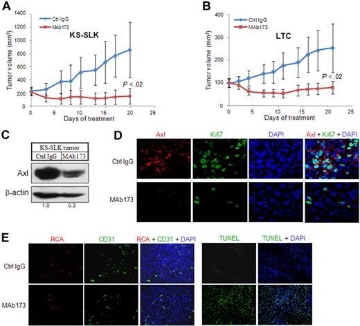 Figure 6. MAb173 inhibits KS tumor growth in vivo. (A) Athymic mice were implanted with 2 × 106 KS-SLK cells. When tumor sizes reached approximately 200 mm3, mice were randomly assigned to treatment groups (5 per group) (day 0). Mice were then treated by intraperitoneal injection of MAb173 (10 mg/kg) or Ctrl IgG, 3 times a week for 20 days. Tumor volume was measured 3 times a week. The P value was calculated by Student t test. (B) LTC xenograft study was performed as in panel A, except that the treatment was started when the tumor sizes were approximately 100 mm3. (C) KS-SLK tumor tissues harvested at the end of the experiment were subjected to Western blot analysis with Axl antibody (rabbit monoclonal). (D) Immunostaining of KS-SLK tumors with Axl antibody (red) and Ki67 antibody (green). Images were taken with a Carl Zeiss confocal microscope (100× objective) and LSM software. (E) Just before tissue harvest, mice were infused with RCA-Lectin. Perfused vessels were localized by RCA-Lectin, and microvascular endothelial cells were localized by CD31 staining. Apoptosis was examined with TUNEL assay. Nuclei were counterstained with DAPI. Images were taken with an Olympus AX70 fluorescence microscope (20× objective) and Spot Version 2.2.2 digital imaging system.