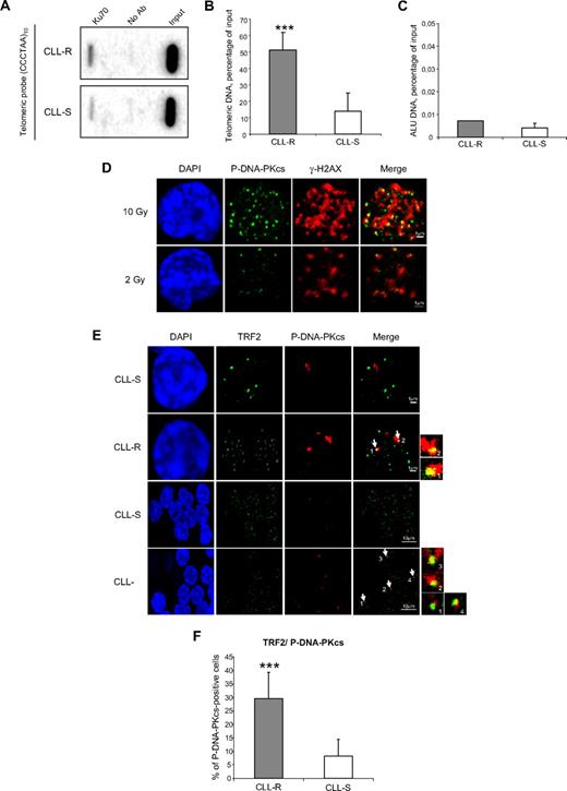 Figure 3. Ku70 and phospho-S2056-DNA-PKcs localize at dysfunctional telomeres in CLL-R cells. (A) Ku70 protein levels at telomeric chromatin in CLL cells. ChIP assays were carried out on 5 CLL-R and 8 CLL-S samples. To exclude nonspecific binding between beads and crosslinked chromatin, a ChIP assay was performed in the absence of any antibody (No Ab). Input represents the total DNA used in each assay. (B) Quantification of the telomeric signals expressed as a percentage of the total telomeric DNA. Bars represent the mean percentage ± SD. (C) Alu probe control analysis. The quantification of the telomeric signal is expressed as described for the telomeric probe. (D) Double immunostaining of γ-H2AX and of phospho-S2056-DNA-PKcs in CLL cells after 2 Gy and 10 Gy irradiations was used as a nuclear labeling control for DNA DSBs. (E) Double immunostaining of phospho-S2056-DNA-PKcs and TRF2. Colocalizations are indicated by arrows. (F) Comparisons of phospho-DNA-PKcs-positive cells between CLL-S and CLL-R samples. Bars represent the mean percentage ± SD. The Mann-Whitney U test was used to assess statistical significance: ***P < .001