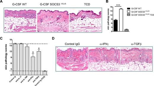 Figure 7. Socs3−/ΔLck T cells exacerbate scleroderma in an IFNγ- and TGFβ-dependent manner. WT or SOCS3−/ΔLck donors were treated with G-CSF, and unfractionated splenocytes containing 3.5 million T cells or T cell–depleted grafts were transplanted into lethally irradiated LP/J recipient mice. (A) Representative images of hematoxylin and eosin–stained skin taken day 14 after transplantation (magnification ×250). (B) Transplant recipients received T cell replete or T cell–depleted grafts from G-CSF–treated WT or SOCS3−/ΔLck donors, and skin histopathology was assessed at day 14 after transplantation as described in “Histology” (n = 12 animals per GVHD group, n = 3 animals per TCD group from 2 replicate experiments). *P < .001, WT versus SOCS3−/ΔLck. (C) Irradiated LP/J transplant recipients of SOCS3−/ΔLck grafts received isotype control mAb or anti–IL-17, anti–IL-10R, anti-IFNγ, or anti-TGFβ mAb thrice/week from day 0 onward. Skin histopathology was assessed at days 14 to 19. Data were pooled from 3 similar experiments (n = 4-17 animals per GVHD group, n = 6 animals per TCD group). Top and bottom dotted lines delineate pathology scores for control GVHD and non-GVHD groups, respectively. (D) Representative images of hematoxylin and eosin–stained skin taken day 14 after transplantation in animals receiving control IgG or anti-IFNγ or anti-TGFβ (magnification ×250). *P < .01, control versus blocking antibody.
