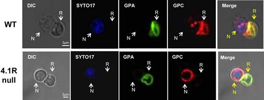 Figure 1. Analysis of GPC sorting during enucleation of WT and 4.1R-null erythroblasts. Differential interference contrast (DIC) and immunofluorescent micrographs of wild-type (WT) and 4.1R-null enucleating erythroblasts, including nascent reticulocyte (R) and extruding nucleus (N), probed with fluorescein isothiocyanate–conjugated TER 119, specific for GPA (green), or Alexa Fluor 555–labeled rabbit anti–mouse GPC antibody (red). Nuclei were identified by Syto-17 staining (blue). The number of enucleating erythroblasts examined under each staining condition was 6 or more. The images were observed by the use of a Zeiss LSM META 510 Confocal microscope (Carl Zeiss Microimaging Inc) with an APOCHROMAT 63×/1.4 oil DIC objective and acquired by the use of Zeiss Laser Scanning Microscope LSM 510, Version 3.2 SP2 software with a Zeiss AxioCam HRm Rev. 2/3.3V camera. The images were processed with the use of Adobe Photoshop (Adobe Systems Inc).
