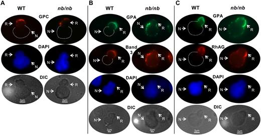 Figure 2. Analysis of band 3, RhAG, and GPA sorting during enucleation of WT and nb/nb erythroblasts. DIC and immunofluorescent micrographs of WT and nb/nb-enucleating erythroblasts, including nascent reticulocyte (R) and extruding nucleus (N); probed with rabbit anti–mouse GPC and Alexa Fluor 594–labeled goat anti–rabbit; IgG (red; A); probed with rat anti–mouse TER 119 and Alexa Fluor 488–conjugated donkey anti–rat IgG (green) or rabbit anti–mouse band 3 and Alexa Fluor 594–labeled goat anti–rabbit IgG (red; B); or probed with rat anti–mouse TER 119 and Alexa 488–conjugated donkey anti–rat IgG (green) or rabbit anti–mouse RhAG and Alexa Fluor 594–labeled goat anti–rabbit IgG (red; C). Nuclei were identified by 4′,6-diamidino-2-phenylindole staining (DAPI; blue). Dashed lines outline the spherical portion of extruding nuclei in the red and green images in which there is no fluorescent labeling of the nucleus. The number of enucleating erythroblasts examined under each staining condition was 6 or more. Of note, during extrusion the nucleus transiently deforms, and a portion of it is visualized within the nascent reticulocyte, as evidenced in these images.