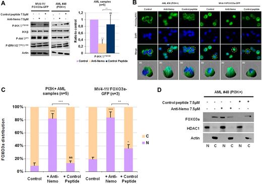 Figure 4. specific blockade of IKK activity induces the nuclear translocation of FOXO3a in leukemic cells. (A) After purification, AML blast cells were cultured during 4 hours in cytokine- and serum-free medium. During the last hour of starvation, cells were treated or not by either the anti-Nemo peptide or the peptide control. MV4-11/FOXO3a-GFP cells were cultured in 10% FCS MEM and treated or not with either the anti-Nemo peptide or the peptide control during 1 hour. Protein extracts from 106 cells were analyzed by Western blot. Phospho-IKK S176/180 was quantified and normalized to IKK signal intensity in 5 different AML samples. Results are expressed as a ratio to the control incubation without either the anti-Nemo peptide or the peptide control. The statistical significance was calculated versus the control condition (except where indicated by brackets) by a Student t test. Vertical bars indicate SDs. (B) FOXO3a localization in both AML cells from 5 different AML samples and MV4-11/FOXO3a-GFP cells treated or not with either the anti-Nemo peptide or the peptide control was investigated as described in Figure 1C. (C) For the quantification of the percentage of cells with nuclear FOXO3a, 100 cells were counted. The statistical significance was calculated versus the control condition (except where indicated by brackets) by a Student t test. Vertical bars indicate SDs. (D) Primary AML blast cells from patient 48 treated or not with the anti-Nemo peptide or the control peptide were subjected to cellular fractionation as described in Figure 1E.