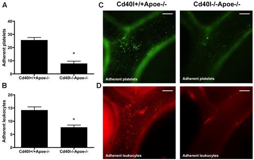 Figure 3. Adhesion of both platelets and leukocytes is impaired after injection of activated Cd40l−/−Apoe−/− platelets. Intravital microscopy of the endothelial wall of carotid arteries in 17-week-old Apoe−/− mice shows an impaired adhesion of intravenously administered calcein-labeled Cd40l−/−Apoe−/− platelets (green) (A). Subsequent rhodamine 6G injection shows a decreased adhesion of leukocytes (red) in Apoe−/− mice injected with Cd40l−/−Apoe−/− platelets compared with mice injected with Cd40l+/+Apoe−/− platelets (B) (n = 6). *P < .05. (C-D) Representative images of the external carotid artery. Scale bars represent 100 μm.