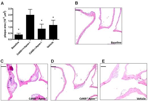Figure 6. Platelet CD40L contributes to the progression of established plaques. Seventeen-week-old Apoe−/− mice were injected with activated Cd40l+/+Apoe−/− or Cd40l−/−Apoe−/− platelets, or vehicle once every 5 days for 12 weeks. (A) Plaque area was quantified in the aortic arch and main branch points at 29 weeks and compared with the baseline lesion size of 17-week-old Apoe−/− mice. (B-E) Representative longitudinal sections (hematoxylin and eosin staining; n = 8/group). *P < .05 vs Cd40l+/+Apoe−/−. Scale bars represent 200 μm.