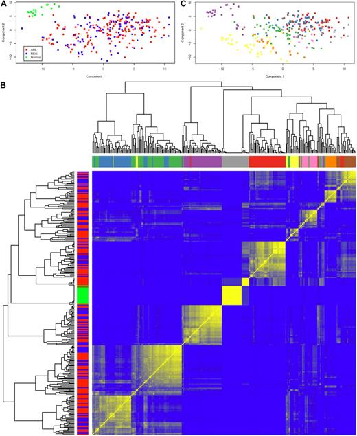 Figure 2. Principal component analysis and unsupervised hierarchical clustering of C&Ckines. (A) Plot of the first 2 PCs of the C&Ckine data. Normal samples (green) form a separate cluster, but MDS (blue) and AML (red) are indistinguishable. (B) Heatmap showing robustness of clustering in the presence of noise with SD = 1. For each of the 9 sample clusters, each sample clustered with almost all of its neighbors in the assigned cluster more than 50% of the time (and many samples did so > 80% of the time). Based on the silhouette width, more than 90% of samples were correctly clustered. Color bars along the y-axis show diagnosis (green represents normal; red, AML; and blue, MDS) and along the x-axis indicate the 9 highest branches in the dendogram. (C) Clustering of samples based on the dendogram in panel C. Unsupervised hierarchical clustering of C&Ckines based on the Pearson correlation of log intensity across samples using average linkage is shown by the dendogram across the top and left side. Results of a bootstrap cluster test of the reproducibility of hierarchical clustering of cytokines is shown with the color indicating the percentage of times that each pair of samples clustered together, with pure blue = 0% and pure yellow = 100%.