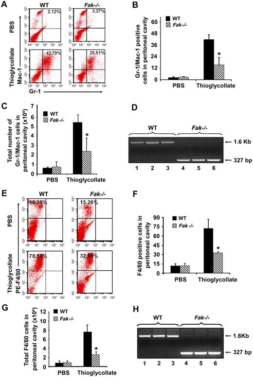 Figure 5. Impaired recruitment of myeloid cells to sites of inflammation in a model of acute peritonitis. (A) Impaired accumulation of Gr-1/Mac-1 double-positive cells in the inflamed peritoneum of Fak−/− mice. WT and FAK−/− mice were given intraperitoneal injections of 4% thioglycollate. Peritoneal lavage was collected 4 hours after injection, and Gr-1 and Mac-1 expression was examined by flow cytometry. Dot blots represent Gr-1/Mac-1–positive cells in the peritoneal cavity of WT and Fak−/− mice, analyzed following PBS or thioglycollate injection. (B) Quantitative analysis of the percentage of Gr-1/Mac-1 double-positive cells in the peritoneal cavity of WT and Fak−/− mice after PBS or thioglycollate injections (n = 3; *P < .05). (C) Quantitative analysis of the total number of Gr-1/Mac-1–positive cells recruited into peritoneal cavity of WT and Fak−/− mice after PBS or thioglycollate injections (n = 3; *P < .05). (D) DNA was extracted from peritoneal cavity-derived cells and analyzed by PCR. Cre-mediated deletion of Fak was detected as a 327-bp fragment, and WT Fak was observed as a1.6-kb fragment. Lanes 1, 2, and 3 represent WT Fak bands after 4 hours of thioglycollate treatment in peritoneal cavity-derived cells. Lanes 4, 5, and 6 shows Fak deletion in peritoneal cavity-derived cells after 4 hours of thioglycollate treatment. (E) WT and FAK−/− mice were given intraperitoneal injections of 4% thioglycollate. Peritoneal lavage was collected 4 days after injection, and F4/80-positive cells were detected by flow cytometry. Upper left quadrant of each dot blot represents the percentage of phycoerythrin-conjugated F4/80-positive cells in WT and FAK−/− peritoneum after PBS or thioglycollate injections. (F) Quantitative analysis of the percentage of F4/80 positive cells in the peritoneal cavity of WT and Fak−/− mice after PBS or thioglycollate injections (n = 3; *P < .05, 4 pairs of WT and Fak−/− mice). (G) Quantitative analysis of the total number of F4/80 cells recruited to the peritoneal cavity of WT and Fak −/− mice after PBS or thioglycollate injection (n = 3; *P < .05, 4 pairs of WT and Fak−/−). (H) DNA was extracted from peritoneal cavity-derived cells and analyzed by PCR. Cre-mediated deletion of FAK was detected as a 327-bp fragment, and the WT Fak allele was observed as a 1.6-kb fragment. Lanes 1, 2, and 3 represent WT Fak bands in the peritoneal cavity-derived cells after 4 days of thioglycollate treatment. Lanes 4, 5, and 6 represent FAK deletion in cells recruited into the peritoneal cavity after 4 days of thioglycollate treatment.