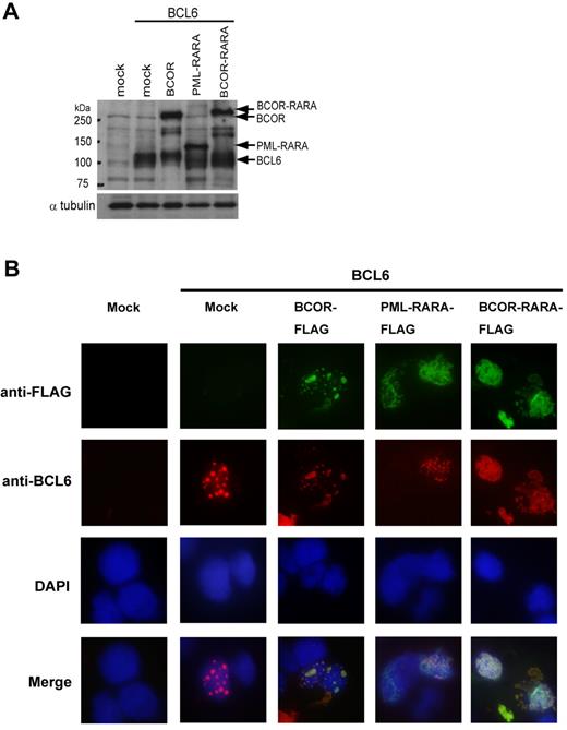 Figure 6. Subcellular localizations of BCOR-RARA and BCL6. (A) Input proteins. Immunoblotting was performed with anti-FLAG and BCL6 antibodies. (B) Coimmunofluorescence analysis was performed in 293T cells transfected with BCL6 and one of mock, Ft-BCOR, Ft-PML-RARA, or Ft-BCOR-RARA plasmids using DAPI for nuclear staining. Multiple confocal microscopy images of the given fields are merged in the lower lane. The patterns of BCOR-RARA localization were analyzed for 100 cells counted.