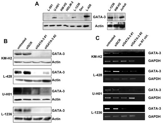 Figure 1. GATA3 expression in classical Hodgkin lymphoma cell lines is effectively altered by small hairpin RNA (shRNA) knockdown. (A) Immunoblots of Hodgkin lymphoma cell lines L-428, L-591, L-1236, KM-H2, HDLM-2, U-HO1, and DEV. Same amount of protein (100 μg) were assayed for protein expression of GATA3. Jurkat T cells were used as positive controls. Actin was used as loading control to demonstrate equal loading. (B) Protein lysates of cell lines treated with lentiviral particles for 2 functional shRNAs (siGATA3 no. 1 and no. 2, lanes 3 and 4) and 1 control scrambled shRNA (siSCR, lane 2) for GATA3 were immunoblotted for GATA3 and actin expression. Lysates were prepared 3 days (L-1236), 4 days (U-HO1), or 5 days after infection (L-428, KM-H2). (C) Three days after infection, GFP+ cells were sorted. After RNA and complimentary DNA preparation, semiquantitative PCRs for GATA3 and GAPDH mRNAs were performed. In the No RT control, RNA of untreated cells was deposited into the complimentary DNA reaction without RT enzyme. A representative experiment of at least 3 independent repeated experiments is shown.