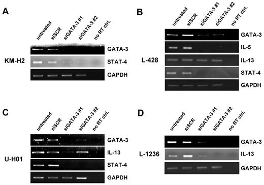 Figure 2. GATA3 downstream targets IL-5, IL-13, and STAT4 are influenced by GATA3 down-regulation. Semiquantitative RT-PCR on sorted GFP+ cells as in Figure 1C on KM-H2 (A), L-428 (B), U-HO1 (C), and L-1236 (D) cells. Messenger RNA of IL-5, IL-13, and STAT4 were amplified. A representative experiment of at least 3 independent repeated experiments is shown for each cell line.
