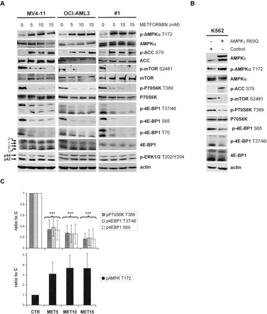 Figure 1. The LKB1/AMPK signaling pathway in AML is functional and controls mTOR activity. (A) Western blot analysis of the phosphorylation levels for AMPKα T172, ACC S79, mTOR S2418, P70S6K T389, 4E-BP1 T37/46, 4E-BP1 S65, 4E-BP1 T70, and p42/44 ERK T202/Y204 in primary AML samples and in the MV4-11 and K562 leukemic cell lines cultured for 24 hours without or with 5, 10, or 15mM metformin. (B) Western blot analysis of the phosphorylation levels of AMPKα T172, ACC S79, mTOR S2481, P70S6K T389, 4E-BP1 T37/46, and 4E-BP1 S65 in the K562 leukemic cell line, expressing the AMPKR69Q activated mutant after adenoviral infection. AMPKR69Q is detected with an anti-AMPKγ antibody. (C) Quantification of Western blot signals. The ratios of phospho-P70S6K T389, phospho-4E-BP1 S65, phospho-4E-BP1 T37/46, or phospho-AMPK T172 to the actin signal intensity were calculated, and results were expressed relative to the control conditions (without metformin) in each experiment. Each histogram represents the mean of 25 independent experiments using primary AML samples, and vertical bars indicate the SEM.