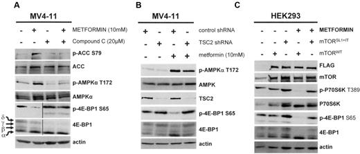 Figure 2. The biologic activity of metformin is dependent upon the integrity of the AMPK/TSC2/mTOR axis. (A) Western blot analysis of the phosphorylation levels of AMPKα T172, ACC S79, and 4E-BP1 S65 in the MV4-11 leukemic cell line treated without or with 20 μM compound C for 30 minutes, then without or with 10mM metformin for 2 additional hours. (B) Western blot analysis of the phosphorylation levels of AMPKα T172, ACC S79, and 4E-BP1 S65 in TSC2 knock-down MV4-11 cells cultured for 24 hours without or with 10mM metformin. (C) Western blot analysis of the phosphorylation levels of P70S6K T389, and 4E-BP1 S65 in HEK293 cells transfected with mTORWT or mTORSL1+IT plasmids and then treated or not with 10mM metformin.