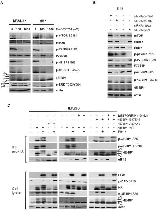 Figure 3. The 4E-BP1 T37/46 priming residues are mTOR-dependent and limiting for translation initiation. (A) Primary AML cells and the MV4-11 cell line were cultured for 1 hour without or with 100 or 1000 nmol/L Ku-0063794. (B) Primary AML cells were transfected with mTOR, raptor, or rictor siRNAs. (C) HEK293 cells were transfected with 4E-BP1WT, 4E-BP1A37A46, 4E-BP1E37E46, and Pim-2 plasmids and then, eventually, treated for 24 hours with 10mM metformin, as indicated. At 48 hours after transfection, cells were lysed in 10% NP-40 lysis buffer and immunoprecipitations were performed using anti-HA antibodies. Immunoprecipitated proteins and whole-cell lysates were then subjected to Western blotting.