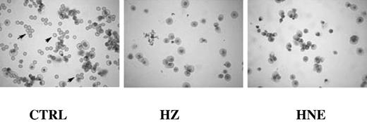 Figure 2. Inhibition of differentiation and growth of erythroid cells cocultivated with HZ or treated with HNE. The May-Grünwald/Giemsa stains of cytospins of cells cultivated for 21 days show numerous fully mature RBCs (arrows) in the untreated control (CTRL) cultures, and negligible numbers of fully mature RBCs in presence of HZ (25μM HZ-heme) or HNE (7μM). Differences in staining and cell size between controls and HZ/HNE-treated cells indicate the delayed differentiation caused by treatments. Optical microscope photographs (Leica DM LB, 40×; acquisition software: Leica DFC Twain, version 6.5.0; camera: Leica DFC 320).