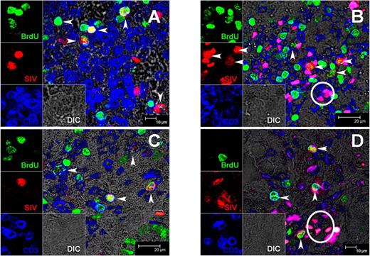 Figure 7. Phenotyping SIV-infected T cells in tissues by combined immunohistochemistry and in situ hybridization for SIV RNA. As indicated by arrows, SIV-infected cells (SIV mRNA, red) are all CD3+ T cells (CD3+, blue). Also note large percentages of the infected cells (deep red) in all tissues examined are proliferating (BrdU+, green) which appear as either red/green or yellow/white (arrows). (A) mesenteric lymph node; (B) spleen; (C-D) intestinal organized lymphoid tissue and lamina propria, respectively. This is easier appreciated in the overlapping individual panels on the left. Also note “fuschia” colored cells in panels B and D are red blood cells that are an artifact of certain immunohistochemical techniques, and should not be interpreted as infected cells. Representative “fuschia” cells are as shown within circles in panels B and D.