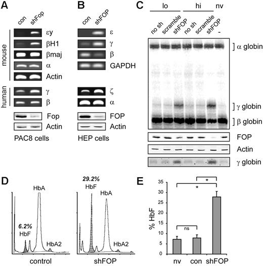 Figure 1. Fop regulates embryonic globin genes in mouse and human erythroid cells. Lentiviral-mediated knockdown of Fop in (A) mouse erythroid progenitor cells containing a single copy of the human globin locus (PAC8) and (B) primary HEP show the specific induction of mouse and human fetal β-like globin genes, as demonstrated by qualitative PCR analysis. Western blot analysis was used to validate Fop knockdown levels (bottom panels). (C) Quantitative S1 nuclease protection assay and Western blot analysis demonstrate significant γ-globin reactivation in HEP cells with reduced FOP expression. (D) Globin high-performance liquid chromatography of transduced HEP cells after 11 days of culture. Peaks for HbA (α2β2), HbA2 (α2δ2), and HbF (α2γ2) are indicated. (E) The shRNA-mediated knockdown of FOP increases HbF levels on average approximately 3.7 times in cultured human erythroid progenitor cells. Cultures from 3 independent healthy donors were analyzed. ns indicates not significant. *Significant difference (Mann-Whitney test, P < .05).