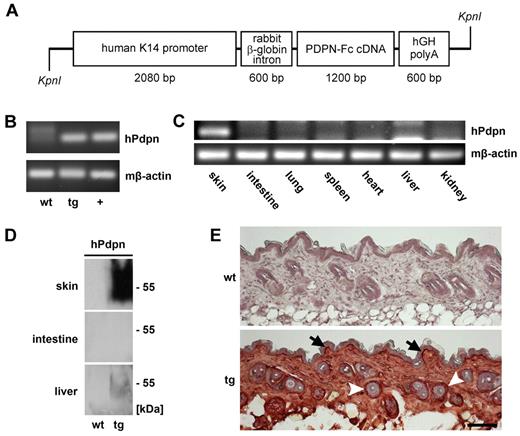 Figure 4. Targeted overexpression of podoplanin-Fc in the skin of transgenic mice. (A) Schematic representation of the K14 podoplanin-Fc transgene construct. (B) Human podoplanin mRNA was detected by RT PCR using total RNA (200 ng) extracted from the skin of wild-type and K14 podoplanin-Fc transgenic mice. RNA (100 ng) from mouse cells transfected with human podoplanin cDNA was used as positive control (+). (C) Human podoplanin mRNA was detected by RT PCR using total RNA (300 ng) extracted from different organs of K14 podoplanin-Fc transgenic mice. (D) Podoplanin-Fc (50-55 kDa) was detected by immunoblot analysis of tissue lysates from skin, intestine, and liver of wild-type and transgenic mice. (E) Podoplanin-Fc was detected by immunohistochemical analysis of paraformaldehyde-fixed cryosections of dorsal skin samples taken from wild-type and transgenic mice at 6 weeks of age. It was expressed at high levels in the basal keratinocyte layer (arrows) and in the outer root sheath keratinocytes of hair follicles (arrowheads). Bar represents 100 μm. Immunoblot and immunohistochemical analyses were performed using antibodies directed against human podoplanin. wt wild-type; tg transgenic; hPdpn human podoplanin.