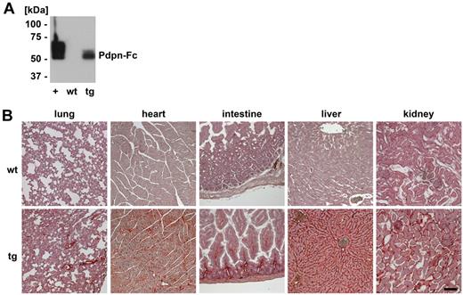 Figure 5. Podoplanin-Fc is present in the blood circulation of K14 podoplanin-Fc transgenic mice. (A) Podoplanin-Fc was detected by immunoblot analysis of serum samples (4 μL) from K14 podoplanin-Fc transgenic and wild-type mice for human podoplanin. Podoplanin-Fc from HEK 293 cells (approximately 1 pmol) was used as positive control (+). (B) Podoplanin-Fc was detected by immunohistochemical analysis of different organs of transgenic and wild-type mice. Bar represents 100 μm. wt wild-type; tg transgenic.
