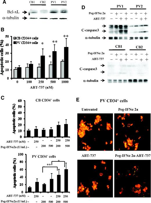 Figure 1. PV CD34+ cells are more sensitive to treatment with ABT-737 than CB and normal bone marrow CD34+ cells. (A) Western blotting demonstrates greater expression of Bcl-xL in PV CD34+ cells than CB CD34+ cells (CB1, CB2, PV1, and PV2). (B) The flow-cytometric analysis results represent the percentage of apoptotic-positive cells observed after the treatment of CB and PV CD34+ cells with ABT-737 at various doses for 3 days. Cells were stained with annexin V. The data were analyzed by the Student t test (*P < .05, **P < .01; n = 6). (C) Effects of 200 and 500 U/mL Peg-IFNα 2a and 250 nM ABT-737 alone and in combination on CB and PV CD34+ cell apoptosis. The numbers of apoptotic cells were also determined flow cytometrically after 3 days of incubation. The data were analyzed by the Student t test (*P < .05, **P < .01; n = 6). (D) Western blotting showed that the cleaved forms of caspase-3 were increased in PV CD34+ cells after treatment with 500 U/mL Peg-IFNα 2a and 250 nM ABT-737 in combination compared with that observed with Peg-IFNα 2a and ABT-737 alone. The α-tubulin serves as the loading control in the Western blot analysis. (E) Effect of Peg-IFNα 2a and ABT-737 alone or in combination on mitochondrial membrane potential in progenitor cells of PV patients. Cells were stained with the JC-1 mitochondrial membrane potential dye after 2 days of treatment with 200 U/mL Peg-IFNα 2a alone, 250 nM of ABT-737 alone, or a combination of 2 drugs. The cells were observed immediately with a fluoroscope (Nikon Eclipse-E600; 10 × .45 objective lens) using a dual-bandpass filter designed to simultaneously detect fluorescein and Texas Red dyes. In live nonapoptotic cells, JC-1 accumulates as aggregates in the mitochondrial membrane which stain red. In apoptotic cells, JC-1 exists in the monomeric form because of the low mitochondrial membrane potential, staining the cytosol green.