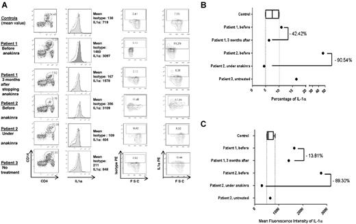 Figure 2. IL-1α expression in PBMCs in 3 ECD patients and 5 healthy controls (CT). (A) Results of flow cytometric analysis for 1 healthy control and the 3 ECD patients. For patient 1, analysis was performed before and 3 months after the end of anakinra treatment, and for patient 2, analysis was conducted before and after 11 months of ongoing treatment. Patient 3 had no treatment. The first column shows the percentage of CD14+CD4dim PBMCs. The second column represents membranous IL-1α expression (colored histogram) compared with the control isotype, with the mean fluorescence intensity (MFI) of each antibody. Column 4 shows the percentage of IL-1α–positive monocytes, and column 3 shows that of the control isotype in the same cells. (B-C) Respectively, the percentage of IL-1α–positive monocytes and the MFI of IL-1α on monocytes for the 5 healthy controls compared with that of the 2 ECD patients before and after treatment with anakinra (patients 1 and 2) and the untreated patient 3. The final levels on (B) and (C) were calculated by subtracting the measured levels of isotype from those of IL-1α on (A); second column for the MFI; third and fourth columns for the percentage.