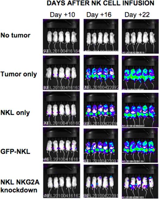 Figure:. Tumor burden in mice . / Luciferase-tagged 721.221 HLA-E EBV LCLs were injected into mice and imaged using a bioluminescence imager at days 10, 16, and 22 following NKL injection. 5 mice were followed in each group.