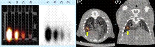Figure 2. SPECT Imaging. (A) through (D) show the radioactivity of electro-transferred 111In-GNPs into T cells. (E) axial and (F) coronal views of directly injection of T cells containing111In-GNPs.